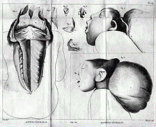 Etienne Geoffroy Saint-Hilaire - «Philosophie Anatomique» tome III, planche IV
