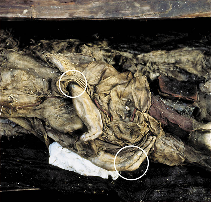 princess of Ukok mummy, with marked tattoo on her arm - credit Siberian Times, queries Will Stewart