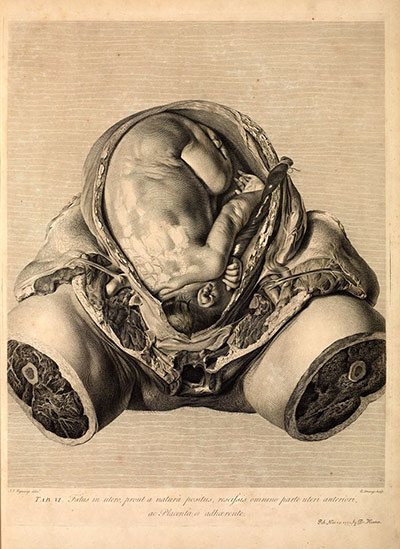 william-hunters-1774-depiction-of-the-uterus-exhibition-at-cambridge