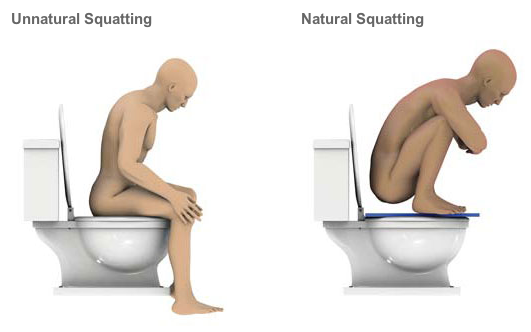unnatural squatting